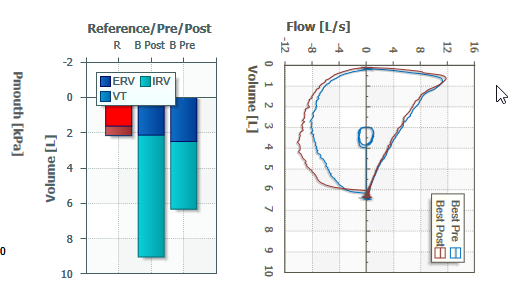 All auto - What I would like is this with the x-axis from 0 to 10. I also have a filter in this chart only allowing values &gt;= 0, but it doesn't prevent auto scaling to -2.